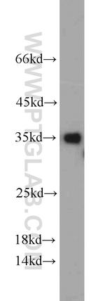 CYB5R3 Antibody in Western Blot (WB)