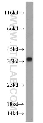 CYB5R3 Antibody in Western Blot (WB)