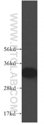 CYB5R3 Antibody in Western Blot (WB)