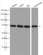 LMNB2 Antibody in Western Blot (WB)