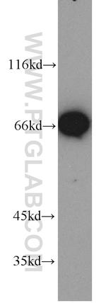 LMNB2 Antibody in Western Blot (WB)