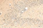 ING4 Antibody in Immunohistochemistry (Paraffin) (IHC (P))