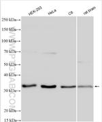 ING4 Antibody in Western Blot (WB)