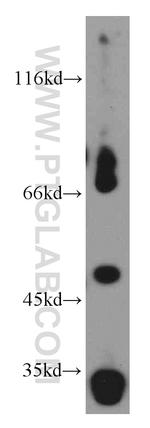 EIF3E Antibody in Western Blot (WB)