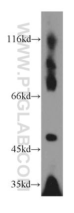 EIF3E Antibody in Western Blot (WB)