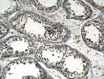 VPS18 Antibody in Immunohistochemistry (Paraffin) (IHC (P))