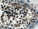 VPS18 Antibody in Immunohistochemistry (Paraffin) (IHC (P))