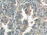 VPS18 Antibody in Immunohistochemistry (Paraffin) (IHC (P))