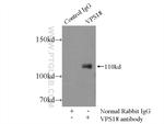 VPS18 Antibody in Immunoprecipitation (IP)