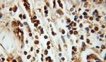 ING3 Antibody in Immunohistochemistry (Paraffin) (IHC (P))