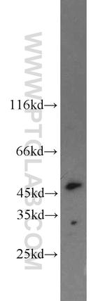 ING3 Antibody in Western Blot (WB)