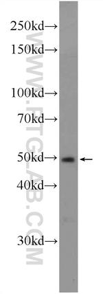 ING3 Antibody in Western Blot (WB)