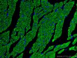 Myosin Light Chain 2 Antibody in Immunohistochemistry (PFA fixed) (IHC (PFA))