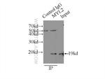 Myosin Light Chain 2 Antibody in Immunoprecipitation (IP)