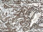 DUSP13 Antibody in Immunohistochemistry (Paraffin) (IHC (P))