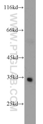 ATP5C1 Antibody in Western Blot (WB)