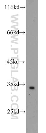 ATP5C1 Antibody in Western Blot (WB)