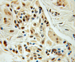 NUDT11 Antibody in Immunohistochemistry (Paraffin) (IHC (P))