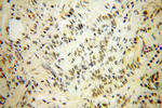 NUDT11 Antibody in Immunohistochemistry (Paraffin) (IHC (P))