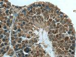 NUDT11 Antibody in Immunohistochemistry (Paraffin) (IHC (P))