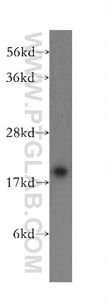 NUDT11 Antibody in Western Blot (WB)