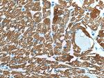 MYL3 Antibody in Immunohistochemistry (Paraffin) (IHC (P))