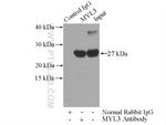 MYL3 Antibody in Immunoprecipitation (IP)