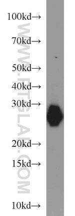 MYL3 Antibody in Western Blot (WB)