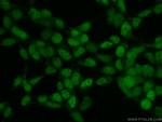 DACH1 Antibody in Immunocytochemistry (ICC/IF)