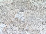 DACH1 Antibody in Immunohistochemistry (Paraffin) (IHC (P))