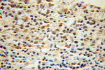 CTCF Antibody in Immunohistochemistry (Paraffin) (IHC (P))