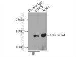 CTCF Antibody in Immunoprecipitation (IP)