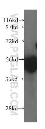 GATA1 Antibody in Western Blot (WB)