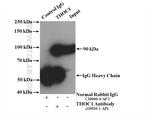 THOC1 Antibody in Immunoprecipitation (IP)