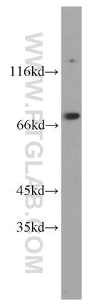 THOC1 Antibody in Western Blot (WB)