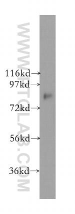 THOC1 Antibody in Western Blot (WB)