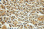 TAF9B Antibody in Immunohistochemistry (Paraffin) (IHC (P))