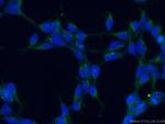 ARP2 Antibody in Immunocytochemistry (ICC/IF)