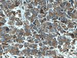 ARP2 Antibody in Immunohistochemistry (Paraffin) (IHC (P))