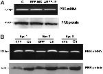 Renin receptor/ATP6AP2 Antibody in Western Blot (WB)