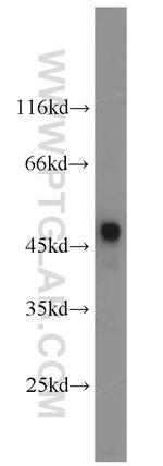 Renin receptor/ATP6AP2 Antibody in Western Blot (WB)