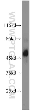 Renin receptor/ATP6AP2 Antibody in Western Blot (WB)