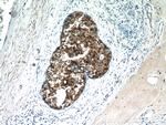 CXCL13/BCA1 Antibody in Immunohistochemistry (Paraffin) (IHC (P))