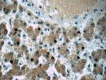 CXCL13/BCA1 Antibody in Immunohistochemistry (Paraffin) (IHC (P))