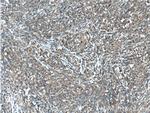 CXCL13/BCA1 Antibody in Immunohistochemistry (Paraffin) (IHC (P))