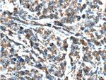 CXCL13/BCA1 Antibody in Immunohistochemistry (Paraffin) (IHC (P))