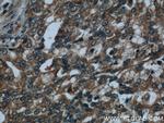 AMPK alpha 1 Antibody in Immunohistochemistry (Paraffin) (IHC (P))