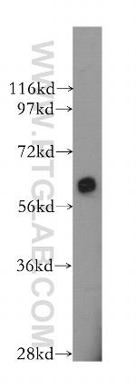 AMPK alpha 1 Antibody in Western Blot (WB)