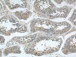 ARPC4 Antibody in Immunohistochemistry (Paraffin) (IHC (P))