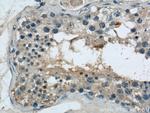 ARPC4 Antibody in Immunohistochemistry (Paraffin) (IHC (P))